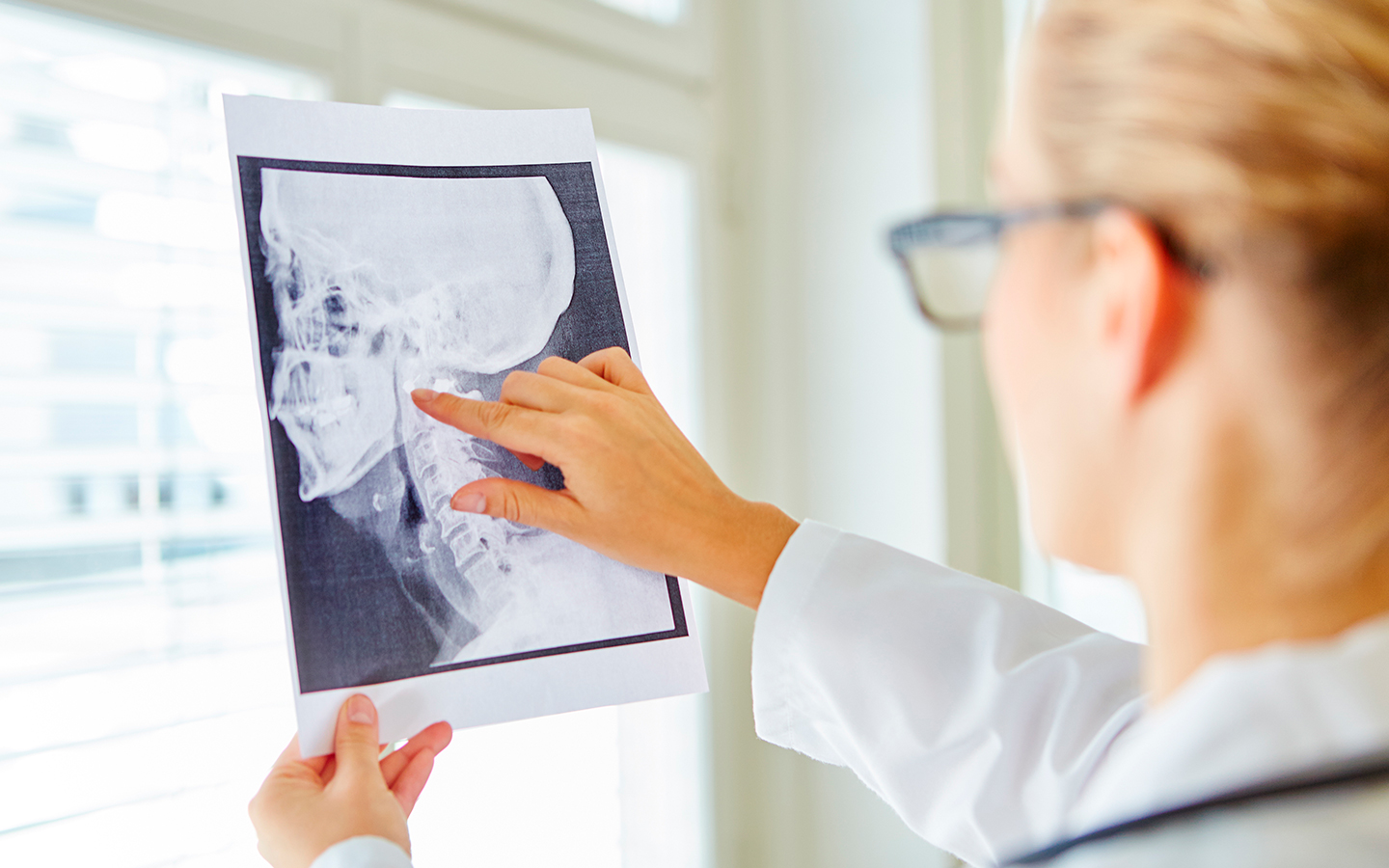 Implantes Dentales en Murcia: Tu Guía Completa para 2024