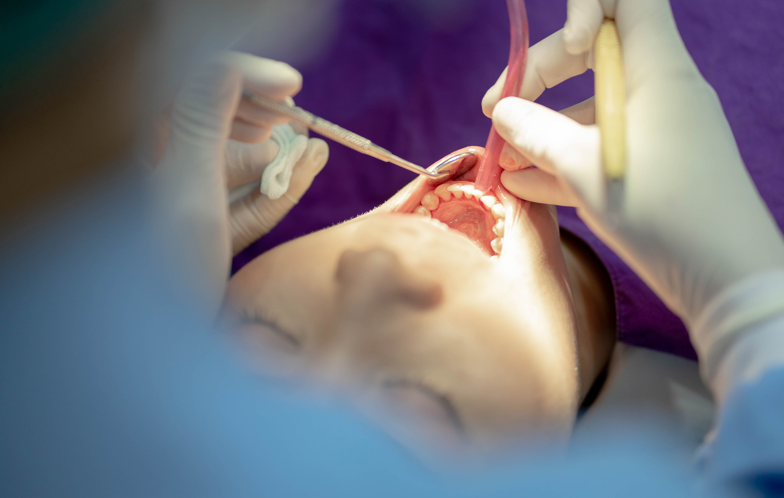 Handling Dental Emergencies for Visitors in Murcia: A Quick Guide