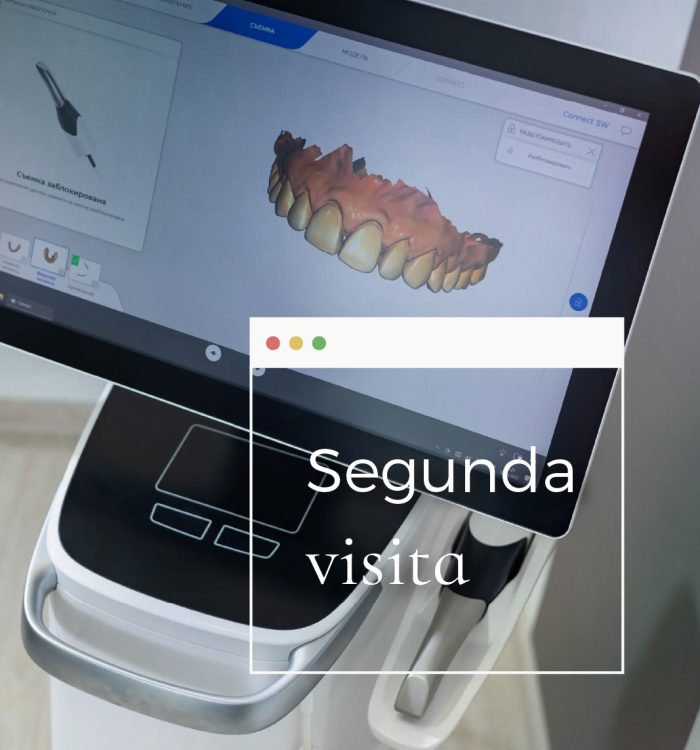 implante-dental-murcia-scaled