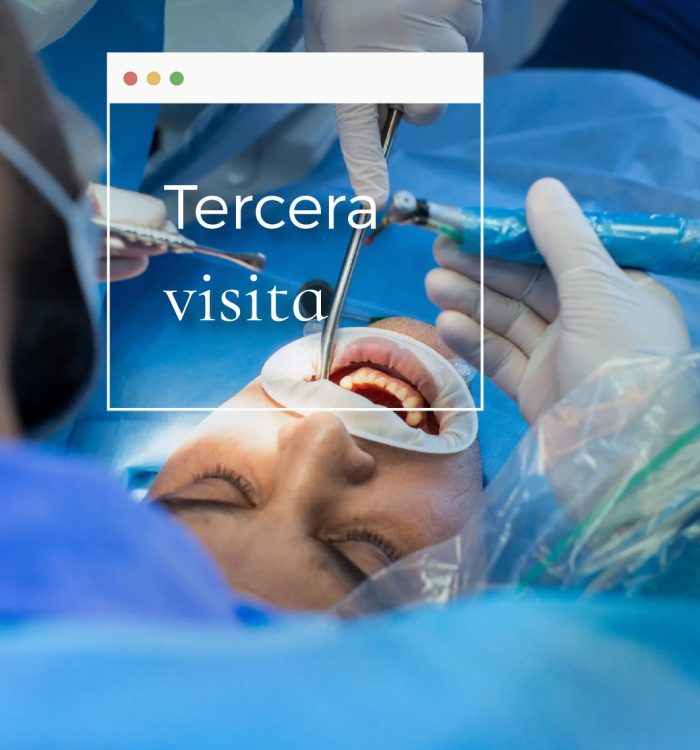 implante-dental-murcia-scaled